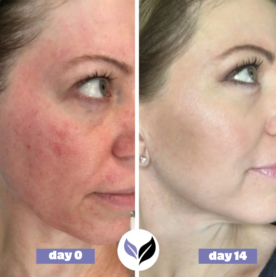 NeutraLab - Haua Korean Skin Care